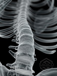 SAGICO - News SPINE MRI IMAGE WM